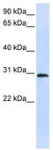 Lymphocyte Antigen 6 Family Member G6F antibody, TA335307, Origene, Western Blot image 