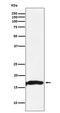 Crystallin Alpha A antibody, M01900-4, Boster Biological Technology, Western Blot image 