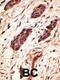 Matrix Metallopeptidase 10 antibody, 62-167, ProSci, Immunohistochemistry paraffin image 