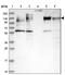 Microtubule Associated Protein 4 antibody, NBP1-89483, Novus Biologicals, Western Blot image 