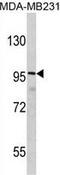 DLG Associated Protein 1 antibody, GTX81689, GeneTex, Western Blot image 