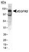 Kinase Insert Domain Receptor antibody, TA336288, Origene, Western Blot image 