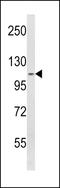 SPINK5 antibody, LS-C161453, Lifespan Biosciences, Western Blot image 