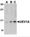 Ubiquitin Conjugating Enzyme E2 V1 antibody, 3375, ProSci, Western Blot image 