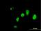 Interferon Gamma Inducible Protein 16 antibody, H00003428-B01P, Novus Biologicals, Immunocytochemistry image 