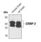 Dihydropyrimidinase Like 2 antibody, PA5-17121, Invitrogen Antibodies, Western Blot image 
