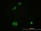 Calcium/Calmodulin Dependent Protein Kinase IV antibody, orb95018, Biorbyt, Immunofluorescence image 