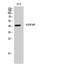 Cell Adhesion Molecule 3 antibody, STJ93659, St John