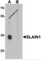 SLAIN Motif Family Member 1 antibody, 6669, ProSci, Western Blot image 