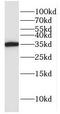 Glyoxalase Domain Containing 4 antibody, FNab03485, FineTest, Western Blot image 