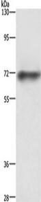 ATP Binding Cassette Subfamily B Member 8 antibody, TA322437, Origene, Western Blot image 