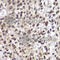 Checkpoint Kinase 2 antibody, A2145, ABclonal Technology, Immunohistochemistry paraffin image 