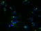 Transmembrane Protein 115 antibody, A61362-100, Epigentek, Immunofluorescence image 