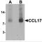 C-C Motif Chemokine Ligand 17 antibody, MBS153725, MyBioSource, Western Blot image 