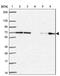 Phenylalanyl-TRNA Synthetase Subunit Beta antibody, NBP2-38917, Novus Biologicals, Western Blot image 