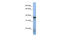 N(Alpha)-Acetyltransferase 30, NatC Catalytic Subunit antibody, 26-320, ProSci, Western Blot image 