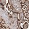 Phosphomevalonate Kinase antibody, HPA029900, Atlas Antibodies, Immunohistochemistry frozen image 