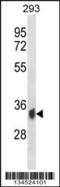 Serine/threonine-protein phosphatase 6 catalytic subunit antibody, 57-821, ProSci, Western Blot image 