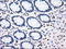 Polo Like Kinase 1 antibody, LS-C784224, Lifespan Biosciences, Immunohistochemistry paraffin image 