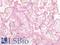 Epstein-Barr Virus Induced 3 antibody, LS-A11282, Lifespan Biosciences, Immunohistochemistry paraffin image 