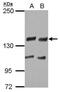Ubiquitin Specific Peptidase 8 antibody, PA5-27947, Invitrogen Antibodies, Western Blot image 