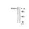 Protein Tyrosine Kinase 2 antibody, LS-C117606, Lifespan Biosciences, Western Blot image 