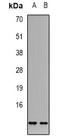 Chromogranin A antibody, orb387976, Biorbyt, Western Blot image 