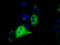 Insulin Like Growth Factor 2 MRNA Binding Protein 2 antibody, TA501272, Origene, Immunofluorescence image 