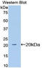 Sialic Acid Binding Ig Like Lectin 12 (Gene/Pseudogene) antibody, LS-C301161, Lifespan Biosciences, Western Blot image 