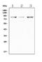 Leukocyte tyrosine kinase receptor antibody, PA1990, Boster Biological Technology, Western Blot image 