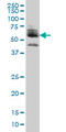 Zinc Finger Protein 345 antibody, LS-C105128, Lifespan Biosciences, Western Blot image 