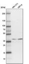 Protein Geranylgeranyltransferase Type I Subunit Beta antibody, PA5-56529, Invitrogen Antibodies, Western Blot image 