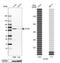Chaperonin Containing TCP1 Subunit 6A antibody, NBP2-46686, Novus Biologicals, Western Blot image 