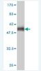 VHL-interacting deubiquitinating enzyme 2 antibody, H00010868-M01, Novus Biologicals, Western Blot image 