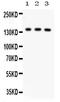 ATP Binding Cassette Subfamily B Member 11 antibody, PA5-78690, Invitrogen Antibodies, Western Blot image 