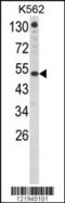 Interferon Alpha And Beta Receptor Subunit 1 antibody, 63-512, ProSci, Western Blot image 