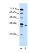 Solute Carrier Family 25 Member 32 antibody, NBP1-59583, Novus Biologicals, Western Blot image 