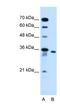 Solute Carrier Family 25 Member 32 antibody, NBP1-59583, Novus Biologicals, Western Blot image 