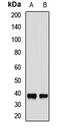 Mediator Complex Subunit 4 antibody, LS-C668318, Lifespan Biosciences, Western Blot image 