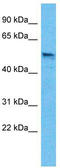 Gamma-Aminobutyric Acid Type A Receptor Beta3 Subunit antibody, TA329171, Origene, Western Blot image 