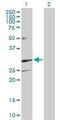 Triggering Receptor Expressed On Myeloid Cells 1 antibody, ab104413, Abcam, Western Blot image 