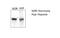 Sequestosome 1 antibody, NBP1-49954, Novus Biologicals, Western Blot image 