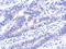 VPS33A Core Subunit Of CORVET And HOPS Complexes antibody, NBP2-20872, Novus Biologicals, Immunohistochemistry paraffin image 