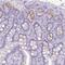 Regenerating Family Member 3 Alpha antibody, NBP2-56947, Novus Biologicals, Immunohistochemistry frozen image 