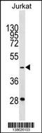 General Transcription Factor IIIA antibody, 60-057, ProSci, Western Blot image 