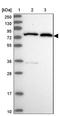 Zinc Finger Protein 776 antibody, NBP1-92644, Novus Biologicals, Western Blot image 