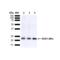 Superoxide Dismutase 2 antibody, 13003, QED Bioscience, Western Blot image 