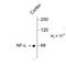 Neurofilament Light antibody, TA309178, Origene, Western Blot image 