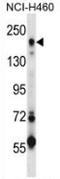 Mannose Receptor C Type 2 antibody, AP52744PU-N, Origene, Western Blot image 