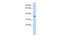 Keratin 222 antibody, A17081, Boster Biological Technology, Western Blot image 